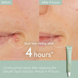 Caudalie The Anti Blemish Duo
