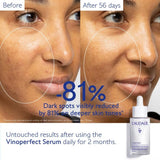 Caudalie Vinoperfect Serum & Suncare Set