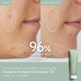 Caudalie Vinopure Pore Purifying Gel Cleanser 75ML