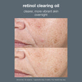Dermalogica Retinol Clearing Oil 30ml