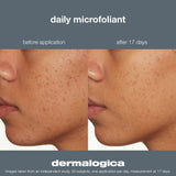 Dermalogica Daily Microfoliant 75G