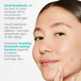 Dermalogica Breakout Biotic Moisturiser 50ml