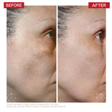 Dr.LEVY Switzerland Radical3 Reboot Pro Peel 50ml