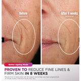 Shark CryoGlow Under-Eye Cooling & LED Anti-Ageing & Blemish Repair Mask In Blue Frost