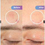 Shark CryoGlow Under-Eye Cooling & LED Anti-Ageing & Blemish Repair Mask In Lilac Chill