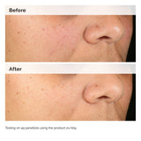 The Ordinary Alpha Arbutin 2% + HA 30ml