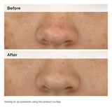 The Ordinary Balancing & Clarifying Serum 30ml