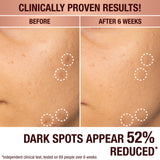 Charlotte Tilbury Dark Spot Correcting Radiance Recovery Serum 30ML