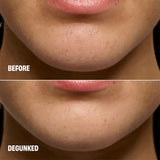 Benefit The POREfessional Degunker Blackhead & Pore Cleansing Tool