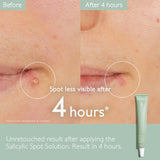 Caudalie The Anti Blemish Duo