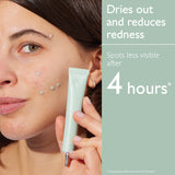 Caudalie The Anti Blemish Duo