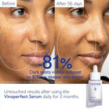 Caudalie Vinoperfect Serum & Suncare Set