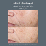 Dermalogica Retinol Clearing Oil 30ml