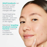 Dermalogica Breakout Biotic Moisturiser 50ml
