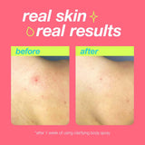Dermalogica Clarifying Body Spray