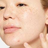 Dermalogica Deep Breakout Liquid Patch
