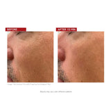 Dr.LEVY The Contour Pro