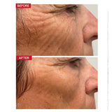 Dr.LEVY The Contour Pro