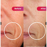 Shark CryoGlow Under-Eye Cooling & LED Anti-Ageing & Blemish Repair Mask In Lilac Chill