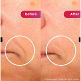 Shark CryoGlow Under-Eye Cooling & LED Anti-Ageing & Blemish Repair Mask In Lilac Chill